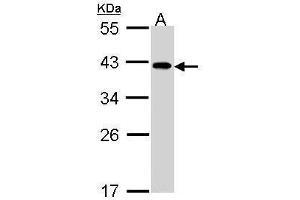 WB Image Sample (30 ug of whole cell lysate) A: A431 , 10% SDS PAGE antibody diluted at 1:1000 (eIF2B beta (Center) Antikörper)