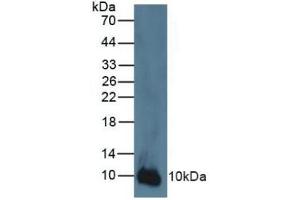 Rabbit Detection antibody from the kit in WB with Positive Control: Human A431 cells.
