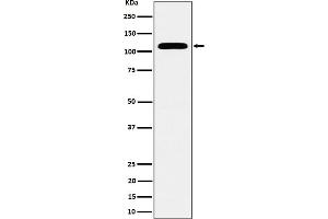 Western blot analysis of SEC24D expression in HeLa cell lysate. (Rekombinanter SEC24D Antikörper)