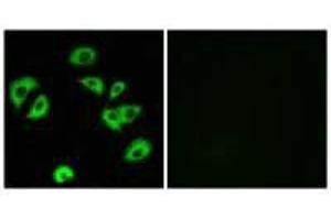 Immunofluorescence analysis of A549 cells, using LILRB4 antibody. (LILRB4 Antikörper)
