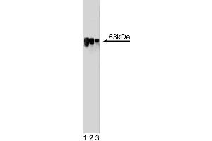 Western blot analysis of LSF on a HCT-8 cell lysate (Human colorectal adenocarcinoma, ATCC CCL-244). (TFCP2 Antikörper  (AA 205-414))