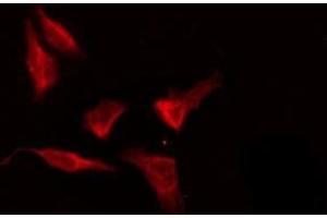 ABIN6276189 staining HeLa by IF/ICC. (OR8G5 Antikörper  (Internal Region))