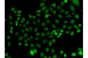 Immunofluorescence analysis of MCF-7 cells using NFYB antibody (ABIN5974397). (NFYB Antikörper)