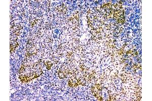 IHC analysis of NFIA using anti-NFIA antibody (ABIN6719349). (NFIA Antikörper  (Middle Region))