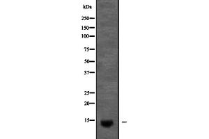 Western blot analysis of KCNE2 expression in Pancreas (Mouse) Tissue Lysate ,The lane on the left is treated with the antigen-specific peptide. (KCNE2 Antikörper  (Internal Region))