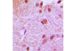 Immunohistochemical analysis of RUNX2 staining in human brain formalin fixed paraffin embedded tissue section. (RUNX2 Antikörper  (Center))