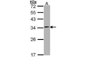 WB Image Sample (30 ug of whole cell lysate) A: Raji 12% SDS PAGE antibody diluted at 1:1000 (Proteasome 20S alpha 1 (Center) Antikörper)