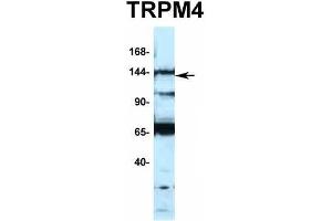 Host:  Rabbit  Target Name:  TRPM4  Sample Type:  Jurkat  Antibody Dilution:  1. (TRPM4 Antikörper  (N-Term))