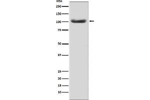 Western blot analysis of MSH2 expression in HeLa cell lysate.