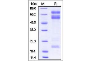 SDS-PAGE (SDS) image for ADAM Metallopeptidase Domain 17 (ADAM17) (AA 18-563) protein (His tag) (ABIN2870711)