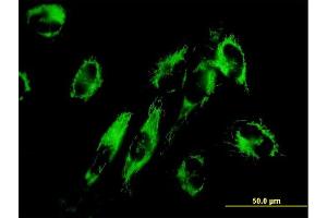 Immunofluorescence of monoclonal antibody to NNT on HepG2 cell. (NNT Antikörper  (AA 1-207))