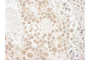 Immunohistochemistry (IHC) image for anti-Denticleless E3 Ubiquitin Protein Ligase Homolog (DTL) (C-Term) antibody (ABIN7448536) (CDT2/RAMP Antikörper  (C-Term))