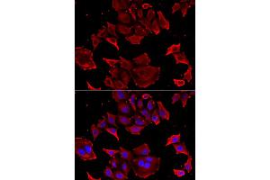 Immunofluorescence analysis of HeLa cells using TCAP antibody.