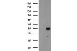 Western Blotting (WB) image for anti-Myeloid Leukemia Factor 1 (MLF1) antibody (ABIN1499494) (MLF1 Antikörper)