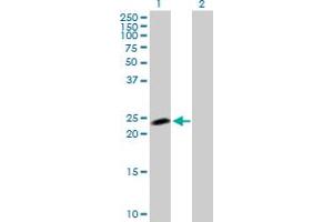 Western Blot analysis of NOP16 expression in transfected 293T cell line by NOP16 MaxPab polyclonal antibody. (NOP16 Antikörper  (AA 1-178))