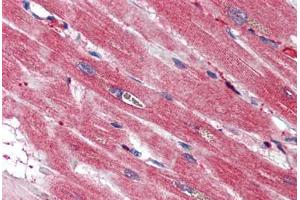 Human Heart (formalin-fixed, paraffin-embedded) stained with S100A4 antibody ABIN337243 at 2. (s100a4 Antikörper)