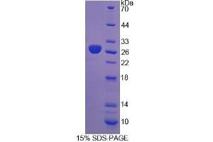 SDS-PAGE analysis of Rat DTNBP1 Protein. (DTNBP1 Protein)