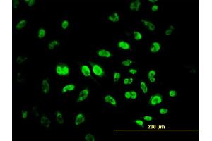 Immunofluorescence of monoclonal antibody to MPG on HeLa cell. (MPG Antikörper  (AA 1-90))