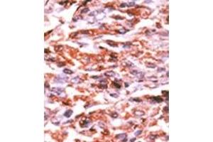 Image no. 1 for anti-Cyclin-Dependent Kinase Inhibitor 1A (p21, Cip1) (CDKN1A) (pSer130) antibody (ABIN358179) (p21 Antikörper  (pSer130))