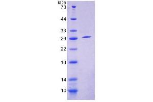SDS-PAGE (SDS) image for Ecto-NOX Disulfide-Thiol Exchanger 2 (ENOX2) (AA 1-207) protein (His tag) (ABIN4989265)