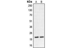 Western blot analysis of CHP2 expression in K562 (A), HT29 (B) whole cell lysates. (Chp2 Antikörper  (Center))