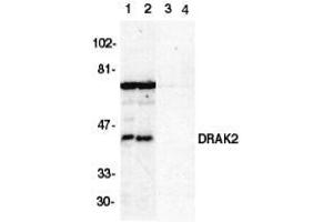 Western blot analysis of DRAK2 in Jurkat (1,3) and Raji (2,4) cell lysate in the absence (1,2) or presence (3,4) of blocking peptide with AP30303PU-N DRAK2 antibody at 1/500 dilution. (DRAK2 Antikörper  (C-Term))