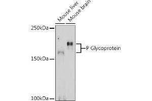Western Blotting (WB) image for anti-ATP-Binding Cassette, Sub-Family B (MDR/TAP), Member 1 (ABCB1) (AA 600-700) antibody (ABIN6136339)