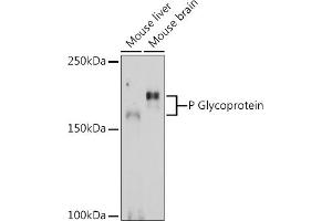 Western blot analysis of extracts of various cell lines, using P Glycoprotein Rabbit pAb (ABIN6134228, ABIN6136339, ABIN6136342 and ABIN6215442) at 1:1000 dilution. (ABCB1 Antikörper  (AA 600-700))