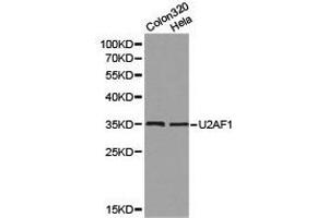 Western Blotting (WB) image for anti-U2 Small Nuclear RNA Auxiliary Factor 1 (U2AF1) antibody (ABIN1875401)