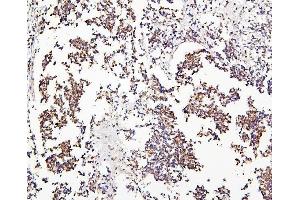 IHC analysis of CRB1 using anti-CRB1 antibody (ABIN6719658).