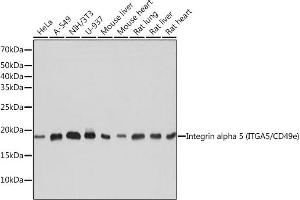 Western blot analysis of extracts of various cell lines, using Integrin alpha 5 (ITG/CD49e) (ITG/CD49e) antibody (ABIN7267936) at 1:1000 dilution.