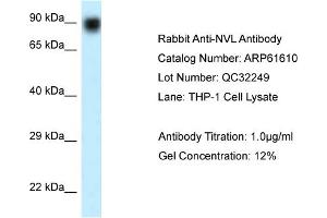 Western Blotting (WB) image for anti-Nuclear VCP-Like (NVL) (N-Term) antibody (ABIN2788850) (NVL Antikörper  (N-Term))