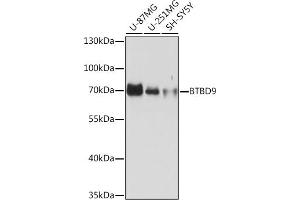 Western blot analysis of extracts of various cell lines, using BTBD9 Rabbit pAb (ABIN7265955) at 1:1000 dilution. (BTBD9 Antikörper)