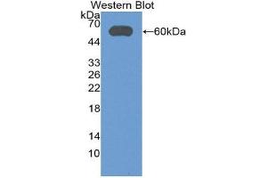 Western Blotting (WB) image for anti-Aldehyde Dehydrogenase 7 Family, Member A1 (ALDH7A1) (AA 1-539) antibody (ABIN3201764) (ALDH7A1 Antikörper  (AA 1-539))