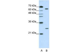 Western Blotting (WB) image for anti-Nudix (Nucleoside Diphosphate Linked Moiety X)-Type Motif 21 (NUDT21) (N-Term) antibody (ABIN2779017)