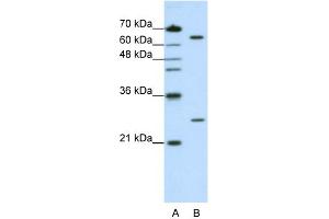 WB Suggested Anti-NUDT21 Antibody Titration:  1. (NUDT21 Antikörper  (N-Term))