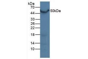 Detection of LXRa in Mouse Liver Tissue using Polyclonal Antibody to Liver X Receptor Alpha (LXRa) (NR1H3 Antikörper  (AA 93-432))