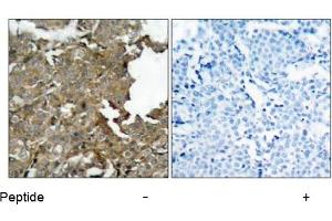 Image no. 1 for anti-Cofilin 1 (CFL1) (AA 1-5), (N-Term) antibody (ABIN197372) (Cofilin Antikörper  (N-Term))