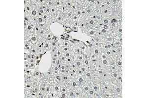Immunohistochemistry of paraffin-embedded mouse liver using CTNNB1 antibody (ABIN4903403) at dilution of 1:100 (40x lens). (CTNNB1 Antikörper)