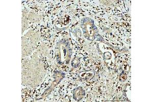 IHC analysis of GPX1 using anti-GPX1 antibody (ABIN3043834). (Glutathione Peroxidase 1 Antikörper  (Middle Region))