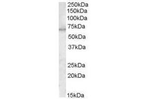 Image no. 1 for anti-Myotubularin 1 (MTM1) (C-Term) antibody (ABIN374119) (MTM1 Antikörper  (C-Term))