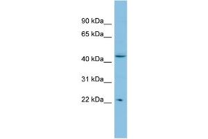 WB Suggested Anti-POLR1E Antibody Titration: 0. (POLR1E Antikörper  (N-Term))