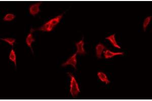ABIN6272414 staining Hela by IF/ICC. (RHOG Antikörper  (Internal Region))