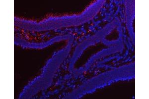 IF analysis of RRS1 using anti-RRS1 antibody (ABIN7602918). (RRS1 Antikörper  (C-Term))