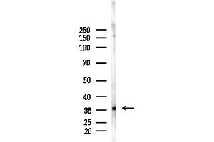 Western blot analysis of lysates from F10-LUC cells(LPS, 4h treatment), using OR52N2 Antibody at 1/1000 dilution.