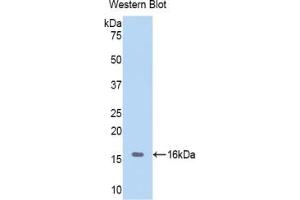 Detection of Recombinant Hemoglobin, Porcine using Polyclonal Antibody to Hemoglobin (HB) (Hemoglobin Antikörper)