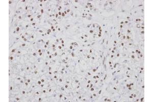 IHC-P Image Immunohistochemical analysis of paraffin-embedded human oral tissue, using PUF60, antibody at 1:100 dilution.