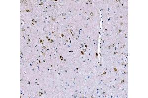 IHC analysis of SCRN1 using anti-SCRN1 antibody (ABIN7602923). (Secernin 1 Antikörper  (C-Term))