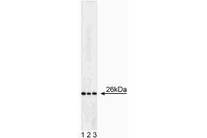 Western blot analysis of Bcl-2. (Bcl-2 Antikörper)