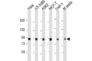 All lanes : Anti-TBK1 Antibody  at 1:2000 dilution Lane 1: Hela whole cell lysate Lane 2: HT-1080 whole cell lysate Lane 3: K562 whole cell lysate Lane 4: MCF-7 whole cell lysate Lane 5: THP-1 whole cell lysate Lane 6: mouse testis lysate Lysates/proteins at 20 μg per lane. (TBK1 Antikörper  (AA 150-181))